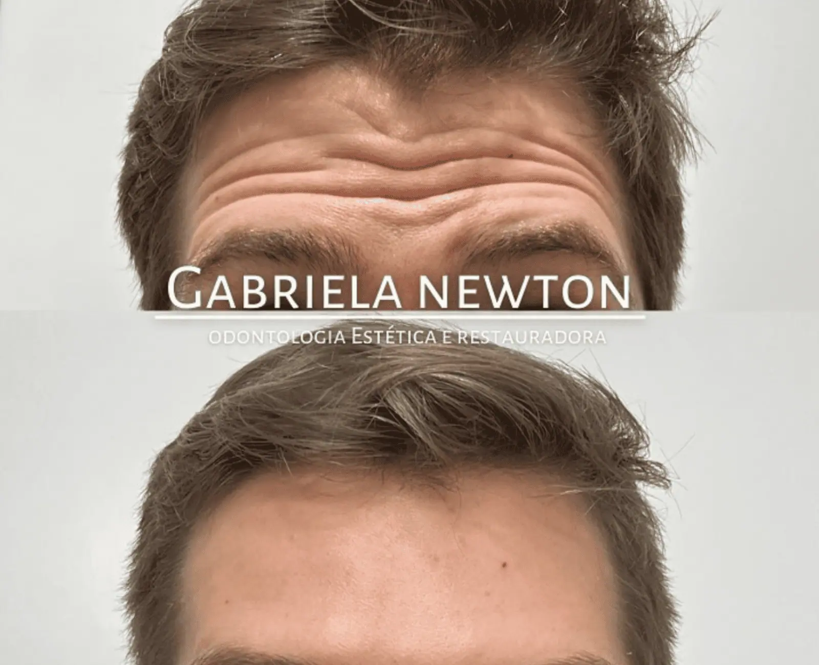Harmonização facial com naturalidade e segurança